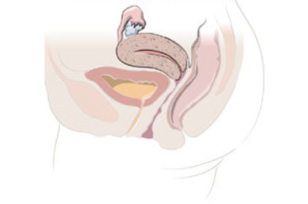 Normale weibliche Anatomie Normale weibliche Anatomie